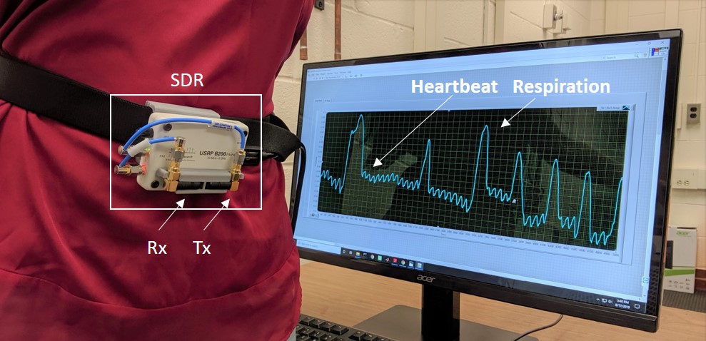 Respiration Heartbeat Signal